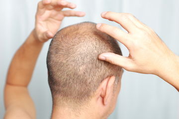 Exfoliating The Scalp for Different Conditions