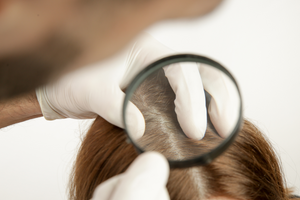 What Do You Know About The Scalp Microbiome?
