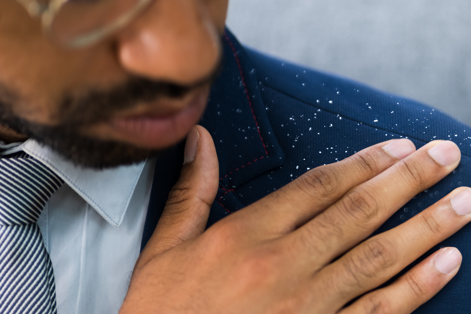 Dry Scalp vs. Dandruff: What You Should Know