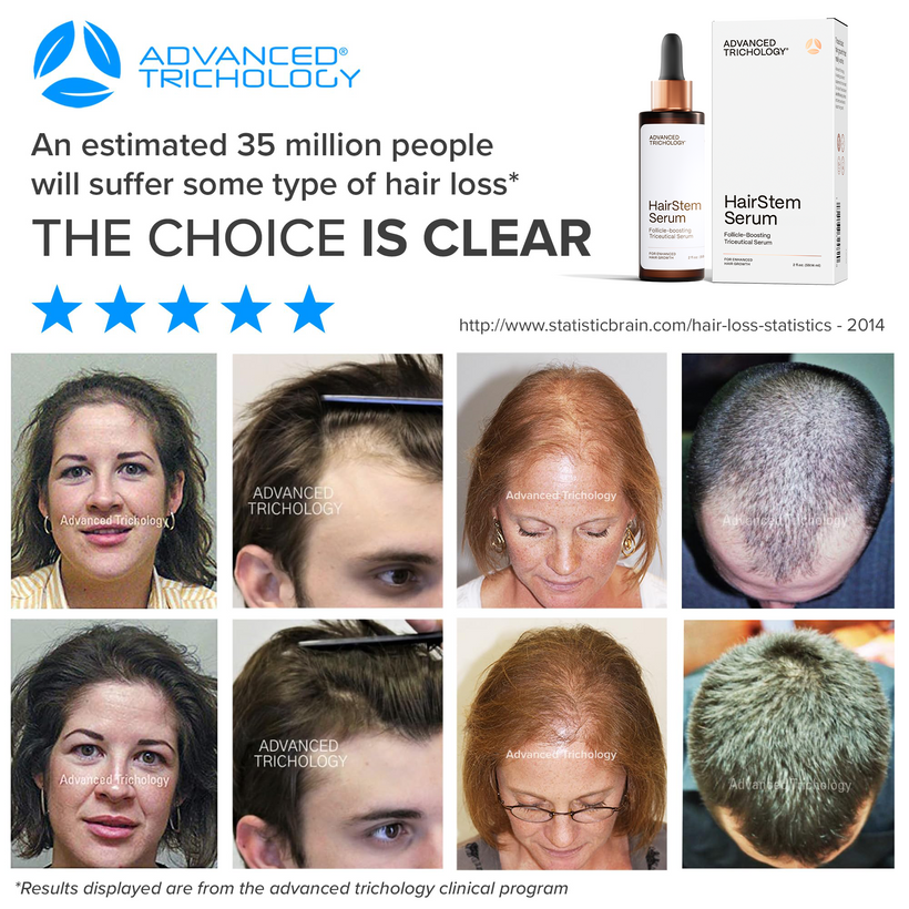 HairStem Serum