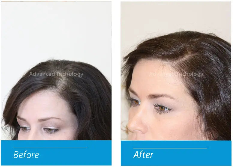 FoliGROWTH Ultimate Hair Nutraceutical