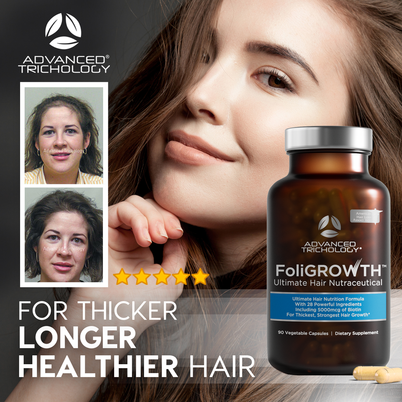 FoliGROWTH Ultimate Hair Nutraceutical
