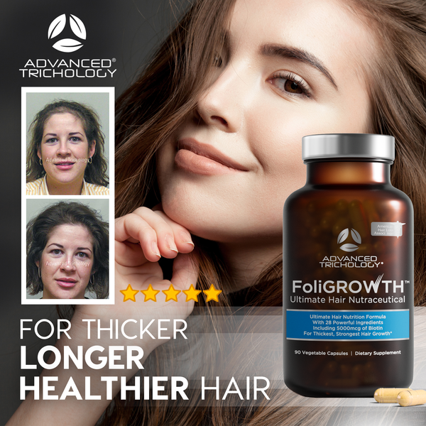 FoliGROWTH Ultimate Hair Nutraceutical