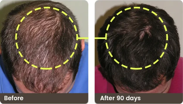 Before and after