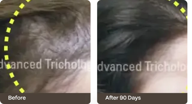 Before and after