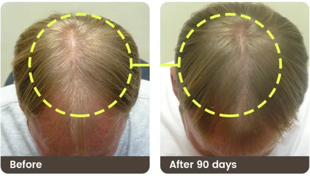 Before and after