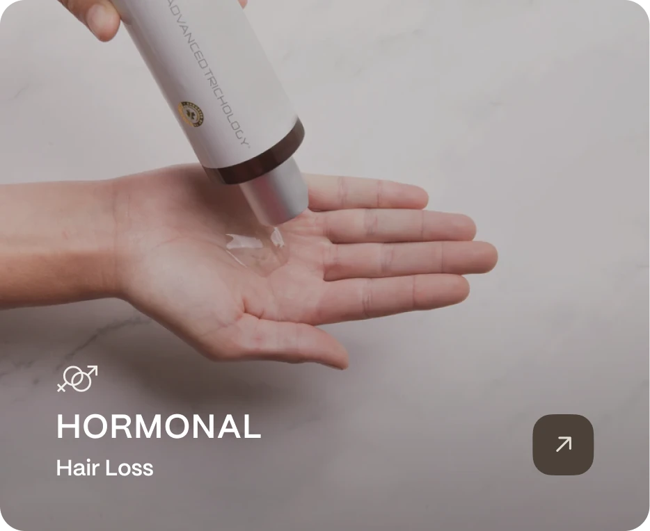 Hormonal Hair Loss