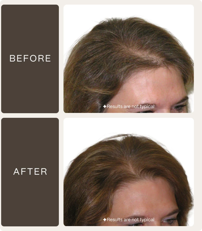 Before — ✦Results are not typical — After