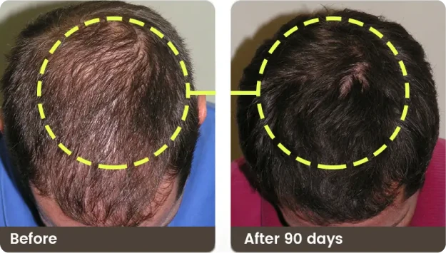 Before and after