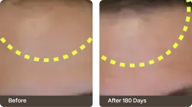 Before and after