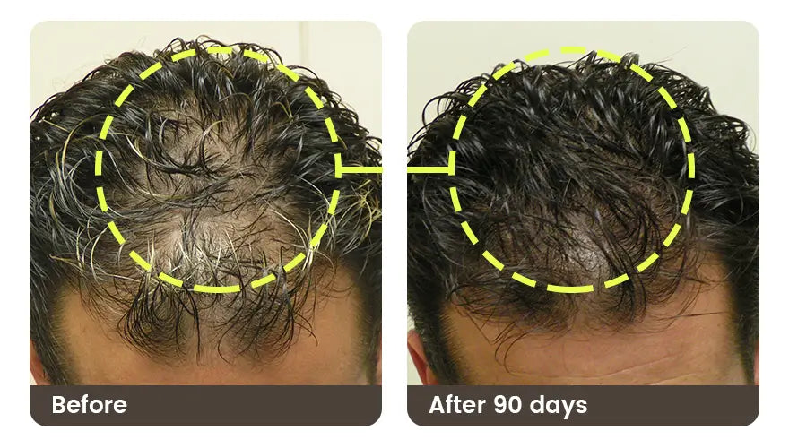 Before and after 90 days: the front and top of a man’s curly hair, thinner before and fuller after