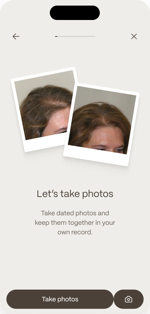 The photo screen: two dated scalp photos and a prompt to take more